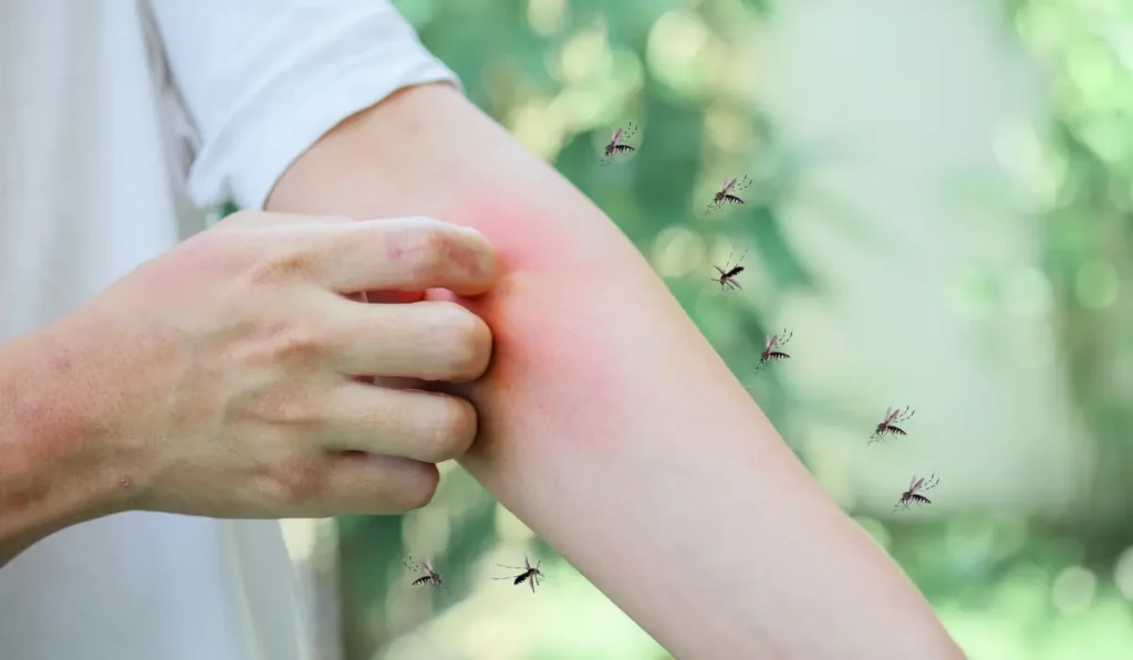 Man itching and scratching on hand from allergy skin rash cause by Mosquitoes bite